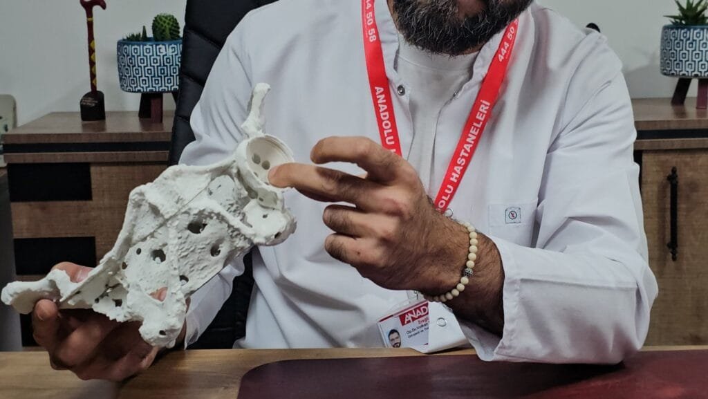 60 yaşındaki kadın 3D yazıcıyla üretilen kalça proteziyle sağlığına kavuştu